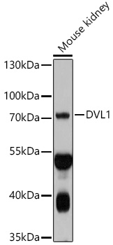A10536_WB_01_(587338).jpg